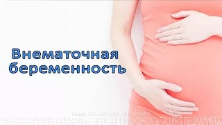 Внематочная беременность. Симптомы и факторы.
