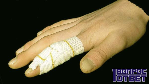 Забинтованный палец - лечение окончено