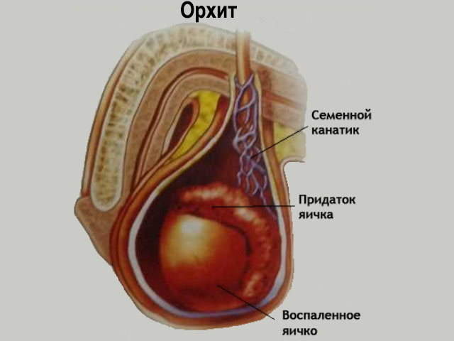 Схематический рисунок 