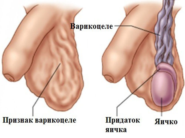 Схематический рисунок 