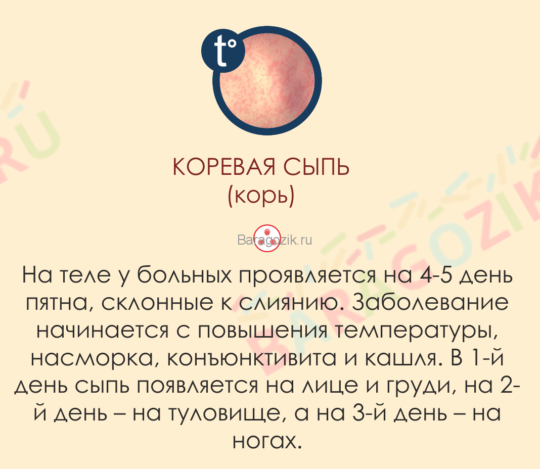 Сыпь при кори