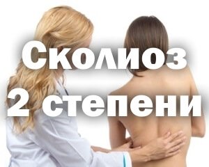 Сколиоз позвоночника 2 степени