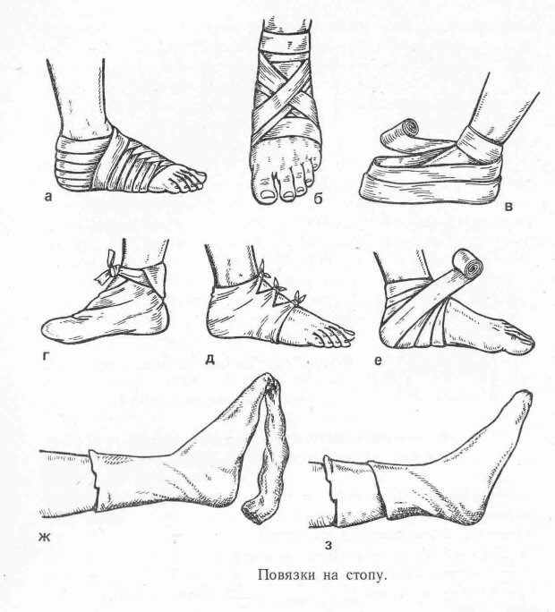 Повязки на стопу