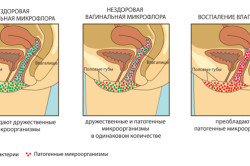 Виды вагинальной микрофлоры