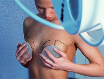 Что надо знать о силиконовых имплантах груди