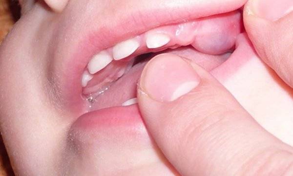 prorezivanie-zubov-2-600x361