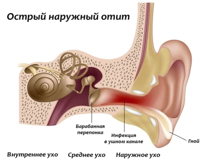 Причины появления воды в ухе