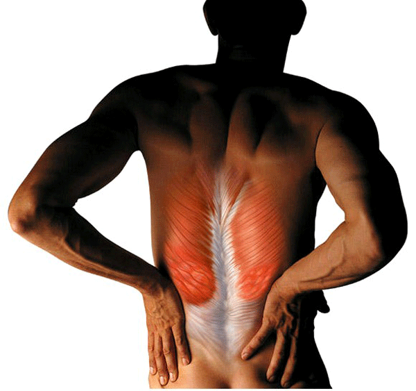 Причины растяжения мышц