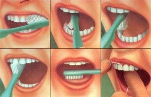 техничка чистки зубов