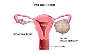 Как проявляется проблема