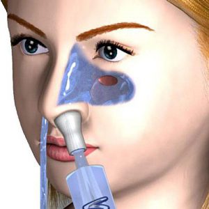 Промывание носа в домашних условиях солевым раствором поможет вам в лечении насморка, гриппа, а также при остром и хроническом тонзиллите