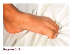 Ris 2 17.jpg