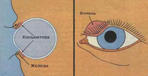 Глазные капли от ячменя