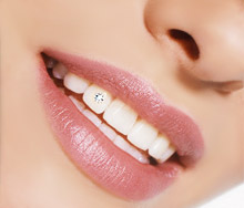 Украшение зубов. Зубные украшения