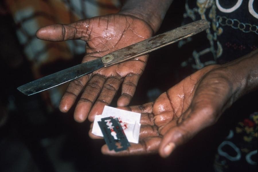 Женское обрезание