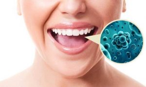активное размножение бактерий во рту
