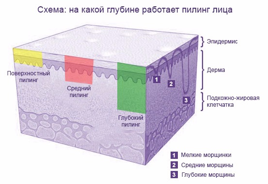 na-kakoj-glubine-rabotaet-piling.jpg