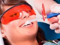 Устранение зубного камня ультразвуком