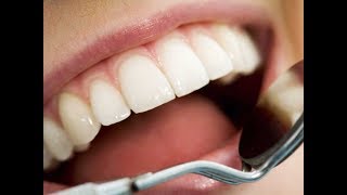 Наращивание зубов с восстановлением эстетики