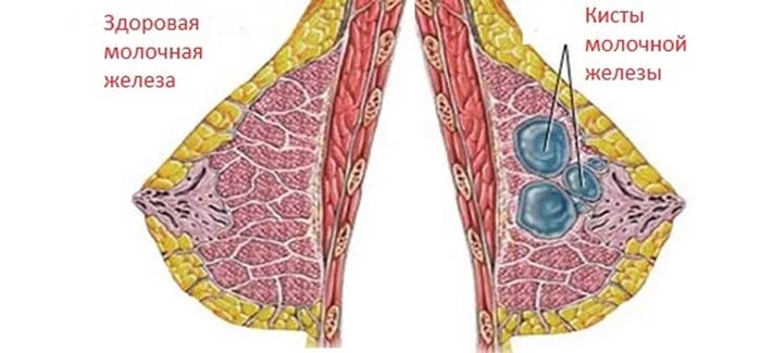 боли в молочной железе