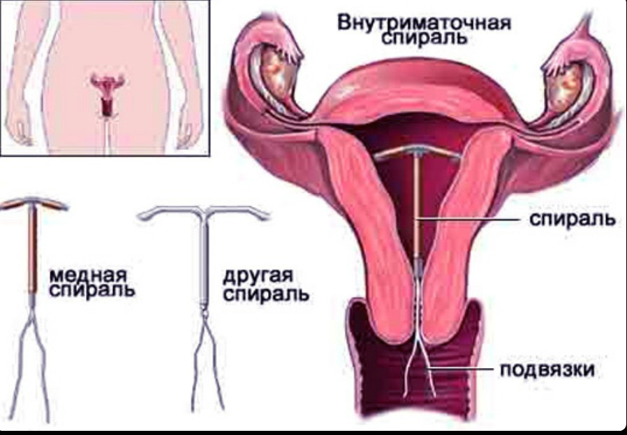 Установка ВМС