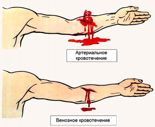 Как остановить кровь из раны: на голове, пальце, руке, лице, во ...