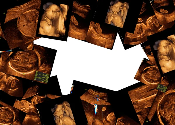 Baby на ультразвуковое изображение — стоковое фото