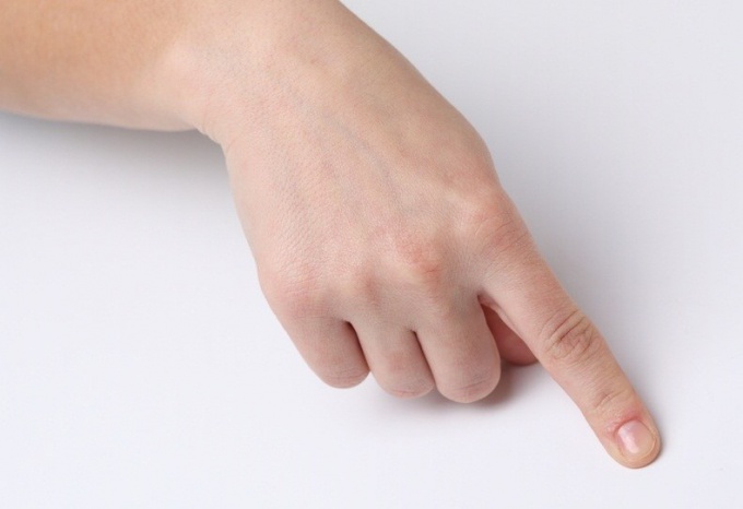 Как лечить ушиб пальца на руке