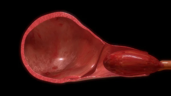 Потянув плаценты из матки — стоковое фото