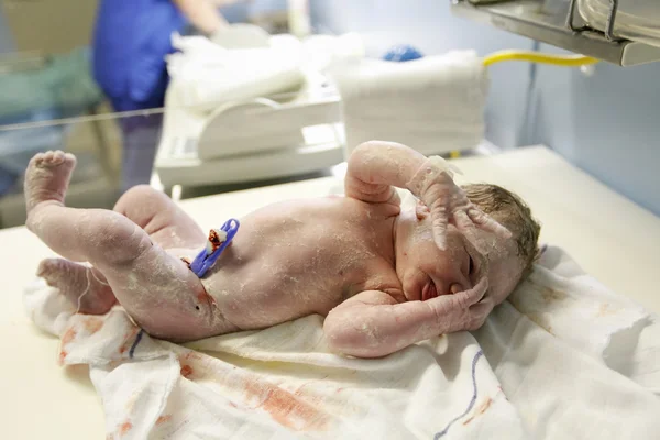 Vernix охватывает новорожденному в родильном зале — стоковое фото