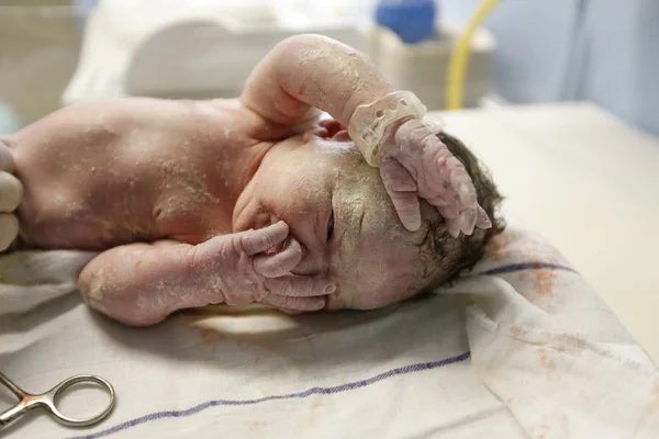Vernix охватывает новорожденных — стоковое фото