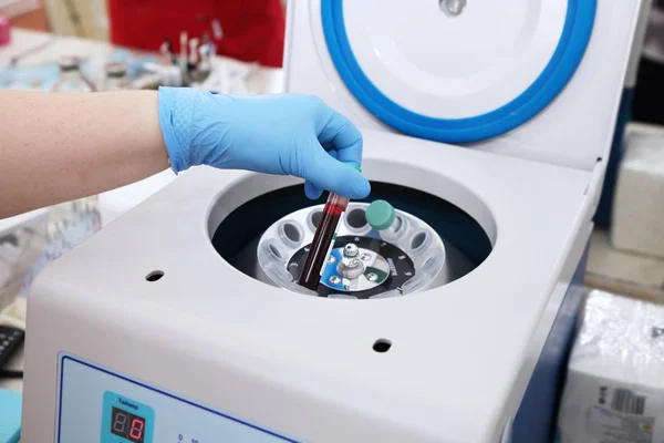 Tube Blood Placed Medical Centrifuge Plasma Lifting — стоковое фото