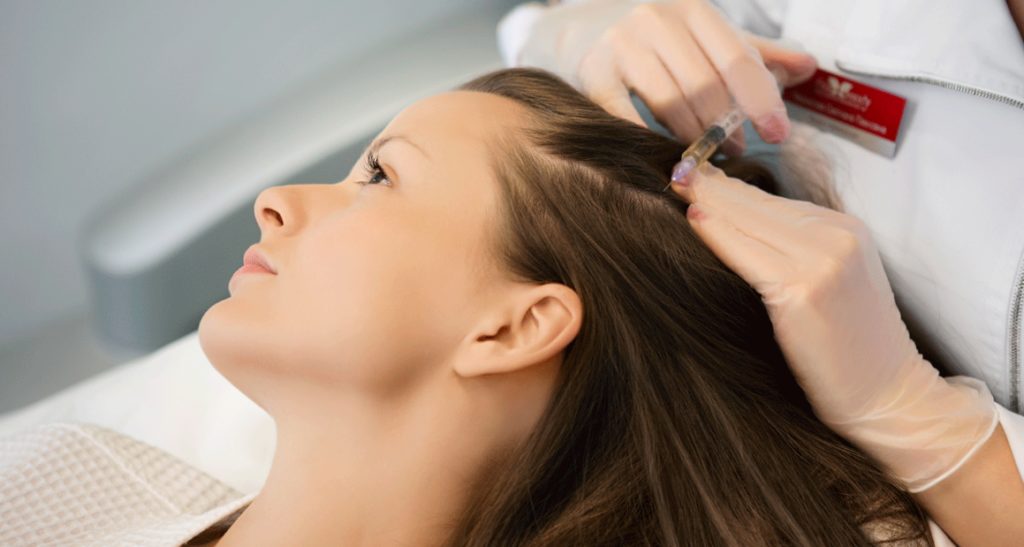 Плазмолифтинг волос - рекомендуют трихологи